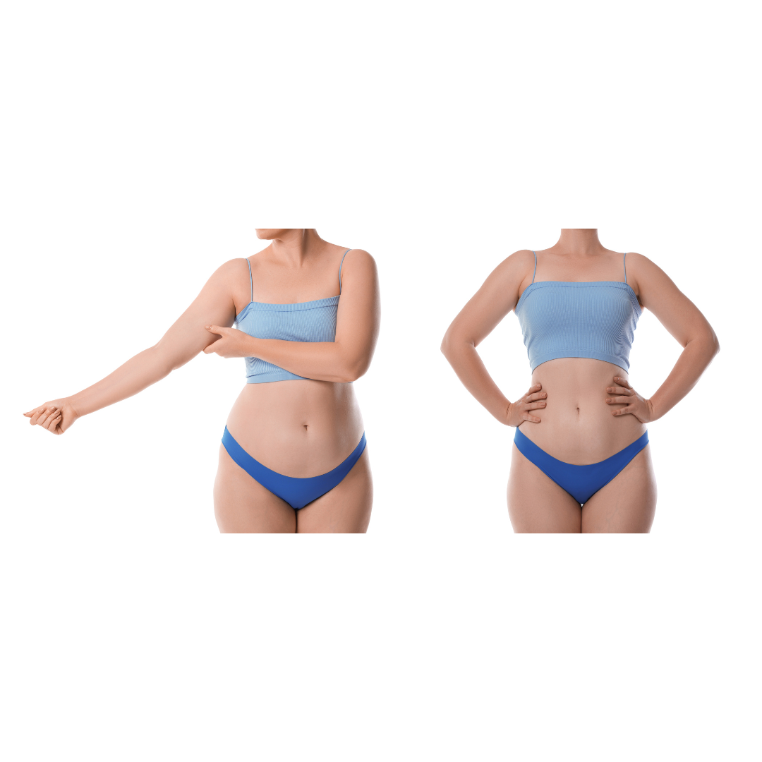 Weight loss transformation